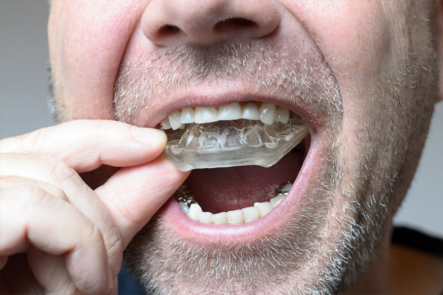 Dental Night Guards in Grande Prairie