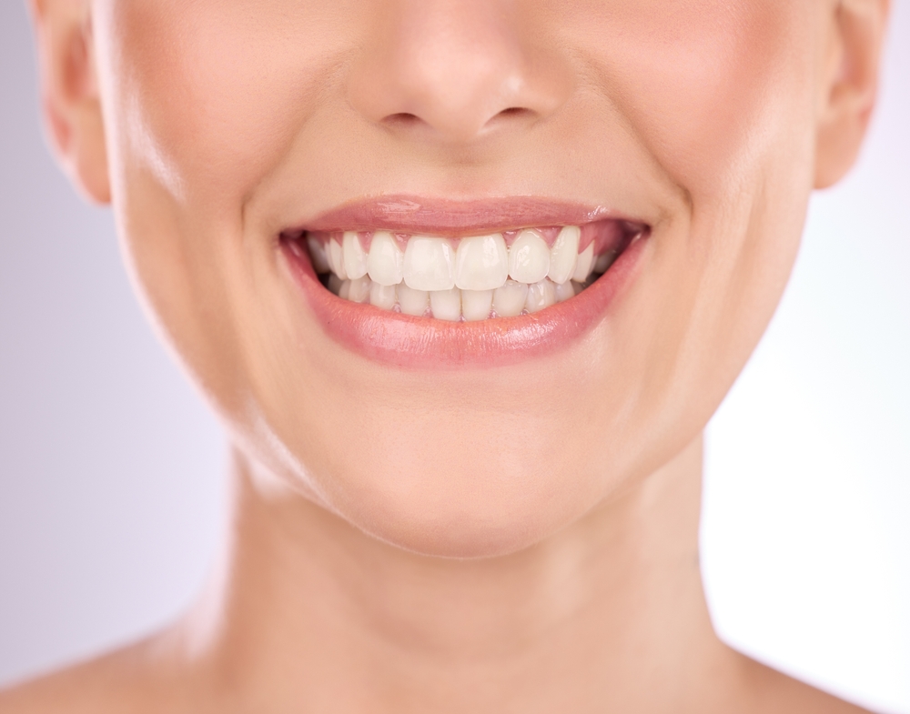 the benefits of teeth whitening is it right for you