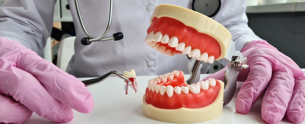 wisdom Tooth Removel in grande Prairie, AB