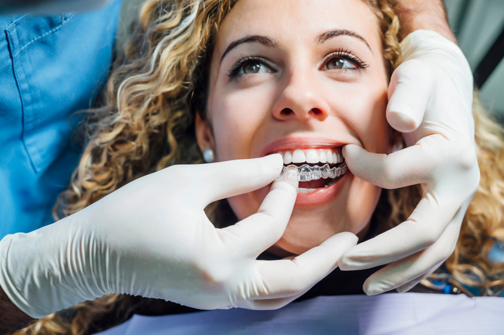 invisalign treatment step by step what to expect at every stage