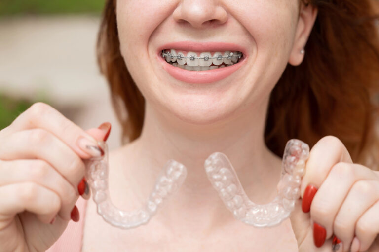 invisalign what makes someone a good candidate